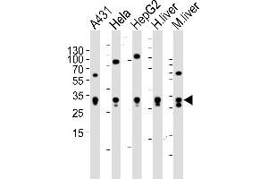 Western blot analysis of lysates from A431, Hela, HepG2 cell line , human liver and mouse liver tissue lysate(from left to right), using ETFA Antibody (Center) (ABIN6243648 and ABIN6577412). (ETFA antibody  (AA 192-226))