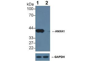 Knockout Varification: ;Lane 1: Wild-type Hela cell lysate; ;Lane 2: ANXA1 knockout Hela cell lysate; ;Predicted MW: 39kDa ;Observed MW: 39kDa;Primary Ab: 2µg/ml Mouse Anti-Human ANXA1 Antibody;Second Ab: 0. (Annexin a1 antibody  (AA 1-346))