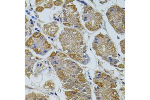 Immunohistochemistry of paraffin-embedded human stomach using TEFM antibody (ABIN5974873) at dilution of 1/100 (40x lens). (TEFM antibody)