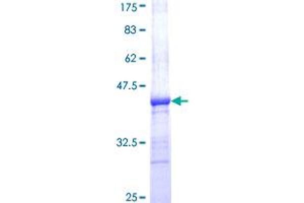 alpha Adaptin Protein (AA 824-923) (GST tag)