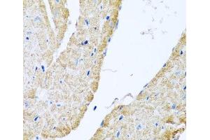 Immunohistochemistry of paraffin-embedded Mouse heart using COX6B1 Polyclonal Antibody at dilution of 1:100 (40x lens). (COX6B1 antibody)