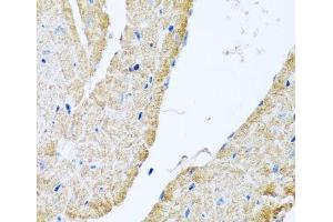 Immunohistochemistry of paraffin-embedded Mouse heart using COX6B1 Polyclonal Antibody at dilution of 1:100 (40x lens).