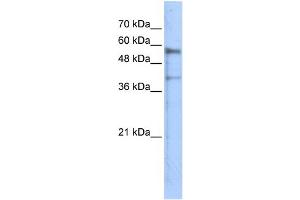 WB Suggested Anti-KREMEN1 Antibody Titration: 0.