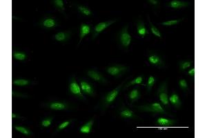Immunofluorescence of monoclonal antibody to OLIG1 on HeLa cell. (OLIG1 antibody  (AA 80-159))