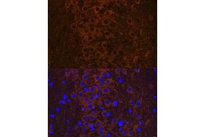 Immunofluorescence analysis of rat brain using Phospho-Tau-T231 antibody (ABIN7268531). (MAPT antibody  (pThr231))