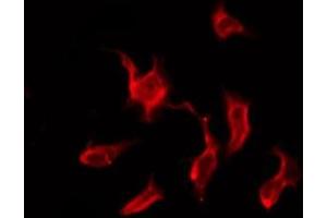 ABIN6276195 staining HeLa by IF/ICC. (OR9G4 antibody  (C-Term))