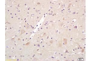 Formalin-fixed and paraffin embedded rat brain labeled with Rabbit Anti Centaurin alpha 1 Polyclonal Antibody, Unconjugated (ABIN1386169) at 1:200 followed by conjugation to the secondary antibody and DAB staining (ADAP1 antibody  (AA 101-200))