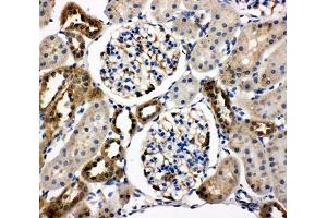 IHC-P testing of rat kidney tissue (WISP1 antibody  (C-Term))