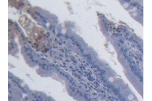 DAB staining on IHC-P; Samples: Rat Small intestine Tissue