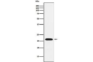 Western Blotting (WB) image for anti-Core-Binding Factor, beta Subunit (CBFB) antibody (ABIN7607018)