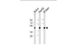 All lanes : Anti-LR6 Antibody (Center) at 1:2000 dilution Lane 1: Molt-4 whole cell lysate Lane 2: HepG2 whole cell lysate Lane 3: Mouse heart tissue lysate Lysates/proteins at 20 μg per lane. (LPAR6 antibody  (AA 106-134))