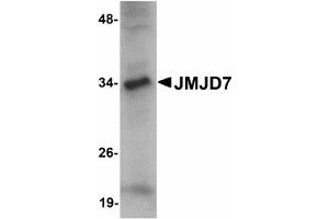 Image no. 1 for anti-Jumonji Domain Containing 7 (JMJD7) (C-Term) antibody (ABIN478159) (JMJD7 antibody  (C-Term))