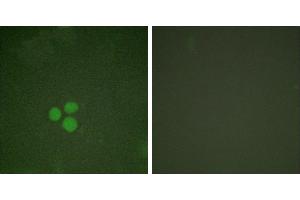 Forskolin + -Immunofluorescence analysis of HeLa cells, treated with Forskolin (40nM, 30mins), using DP-1 antibody. (TGM4 antibody)