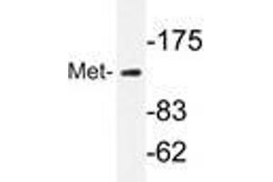 Western blot analyzes of Met antibody in extracts from HepG2 cells. (c-MET antibody)