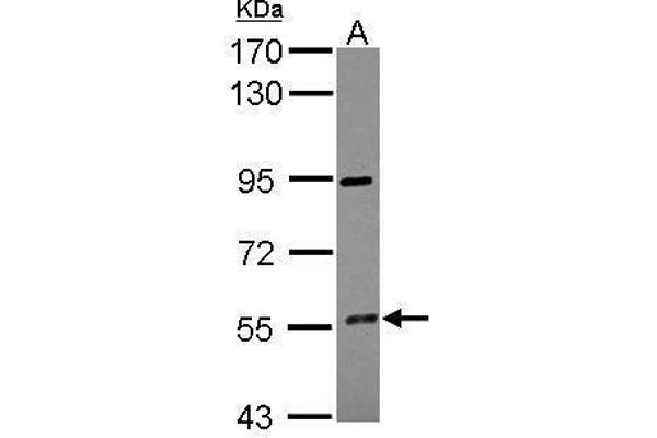 CYP4F12 antibody  (Center)