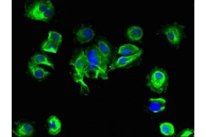 Immunofluorescent analysis of MCF-7 cells using ABIN7145717 at dilution of 1:100 and Alexa Fluor 488-congugated AffiniPure Goat Anti-Rabbit IgG(H+L) (SLC25A14 antibody  (AA 55-111))