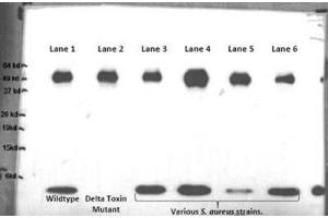 Western Blotting (WB) image for anti-delta Hemolysin antibody (ABIN2998410) (delta Hemolysin antibody)