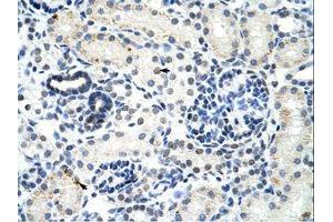 Image no. 1 for anti-DEAD (Asp-Glu-Ala-Asp) Box Polypeptide 17 (DDX17) (AA 570-619) antibody (ABIN203205) (DDX17 antibody  (AA 570-619))
