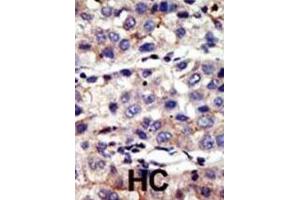 Immunohistochemistry (IHC) image for anti-Proprotein Convertase Subtilisin/kexin Type 2 (PCSK2) antibody (ABIN3001537)