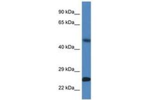 Image no. 1 for anti-Sorting Nexin 10 (SNX10) (AA 100-149) antibody (ABIN6747387) (SNX10 antibody  (AA 100-149))