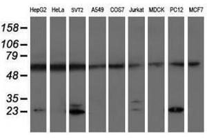 Image no. 2 for anti-Proteasome (Prosome, Macropain) Subunit, beta Type, 9 (Large Multifunctional Peptidase 2) (PSMB9) (AA 21-219) antibody (ABIN1491192) (PSMB9 antibody  (AA 21-219))