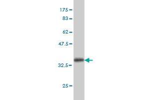 Western Blot detection against Immunogen (36. (TEK antibody  (AA 701-800))