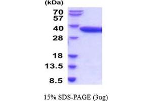 SDS-PAGE (SDS) image for Acid Phosphatase 5, Tartrate Resistant (ACP5) (AA 22-325) (Active) protein (His tag) (ABIN5854325)