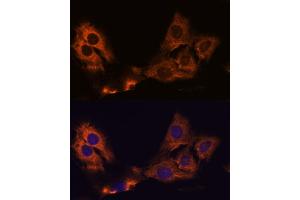 Immunofluorescence analysis of C6 cells using SM antibody (ABIN7270612) at dilution of 1:100. (SMAP1 antibody  (AA 180-250))