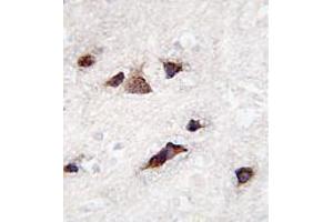 Image no. 3 for anti-Kv Channel Interacting Protein 3, Calsenilin (KCNIP3) (AA 1-30), (N-Term) antibody (ABIN357125) (DREAM antibody  (N-Term))