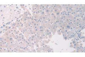Immunohistochemistry (IHC) image for anti-Flightless I Homolog (FLII) (AA 896-1176) antibody (ABIN7436756)