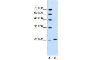 WB Suggested Anti-TRIM26  Antibody Titration: 1.