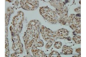 Image no. 1 for anti-Non-SMC Condensin I Complex, Subunit D2 (NCAPD2) (AA 1240-1339) antibody (ABIN599100) (NCAPD2 antibody  (AA 1240-1339))