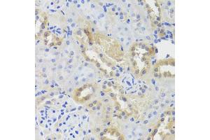 Immunohistochemistry of paraffin-embedded rat kidney using CTSC antibody (ABIN5974676) at dilution of 1/100 (40x lens). (CTSC antibody)