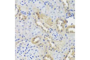 Immunohistochemistry of paraffin-embedded rat kidney using CTSC antibody (ABIN5974676) at dilution of 1/100 (40x lens).
