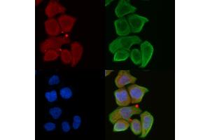 ABIN6262142 and ABIN6272316 staining Hela cells(30 min of UV treatment) by IF/ICC. (HABP2 antibody  (Internal Region))