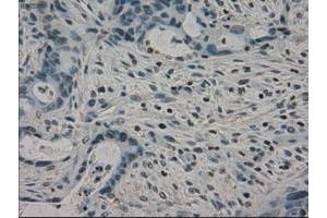 Image no. 5 for anti-Crystallin, alpha B (CRYAB) antibody (ABIN1497645) (CRYAB antibody)