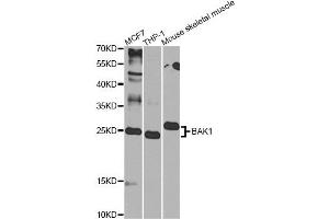 Western blot analysis of extracts of various cell lines, using BAK1 Antibody (ABIN6291814) at 1:1000 dilution.