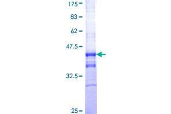 RNF17 Protein (AA 30-139) (GST tag)