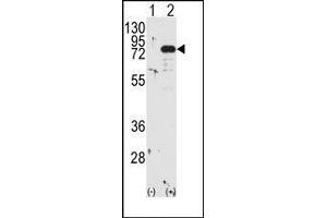 Western blot analysis of PRKCB (arrow) using PKC beta1/2 Antibody (PKC beta antibody  (C-Term))
