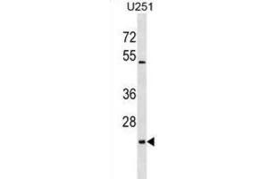 Western Blotting (WB) image for anti-UL16 Binding Protein 2 (ULBP2) antibody (ABIN2999200) (ULBP2 antibody)
