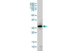 GCH1 monoclonal antibody (M01), clone 4A12 Western Blot analysis of GCH1 expression in IMR-32 . (GCH1 antibody  (AA 84-172))