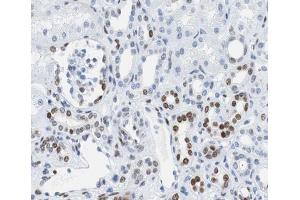 Immunohistochemistry (IHC) image for anti-Retinoblastoma 1 (RB1) (pSer807) antibody (ABIN6256428)