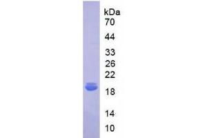 SDS-PAGE analysis of Human IL18BP Protein.