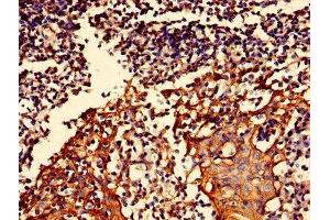 Immunohistochemistry of paraffin-embedded human tonsil tissue using ABIN7166049 at dilution of 1:100 (S1A16 (AA 1-103) antibody)