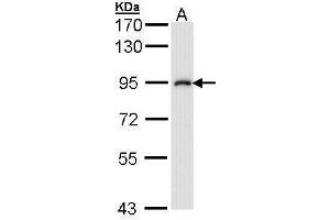 Western Blotting (WB) image for anti-Inhibitor of kappa Light Polypeptide Gene Enhancer in B-Cells, Kinase beta (IKBKB) (C-Term) antibody (ABIN2856162)