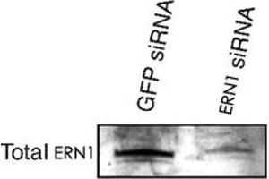 Western blot analysis of ERN1 alpha in transfected min6 cells using ERN1 polyclonal antibody . (ERN1 antibody  (AA 700-800))