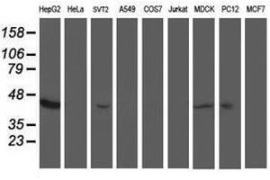 Image no. 3 for anti-Aminoacylase 1 (ACY1) antibody (ABIN1496452) (Aminoacylase 1 antibody)