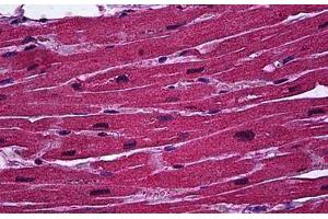 Human Heart: Formalin-Fixed, Paraffin-Embedded (FFPE) (BCL11A antibody  (AA 1-89))