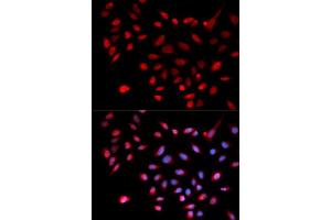 Immunofluorescence analysis of U2OS cell using CDK9 antibody. (CDK9 antibody  (AA 153-372))