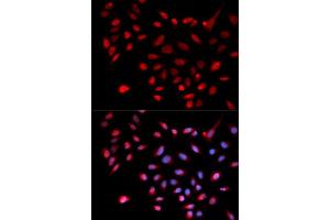 Immunofluorescence analysis of U2OS cell using CDK9 antibody. (CDK9 antibody  (AA 153-372))